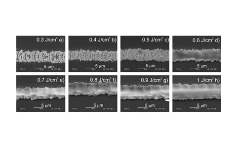 Laser-Induced Forward Transfer